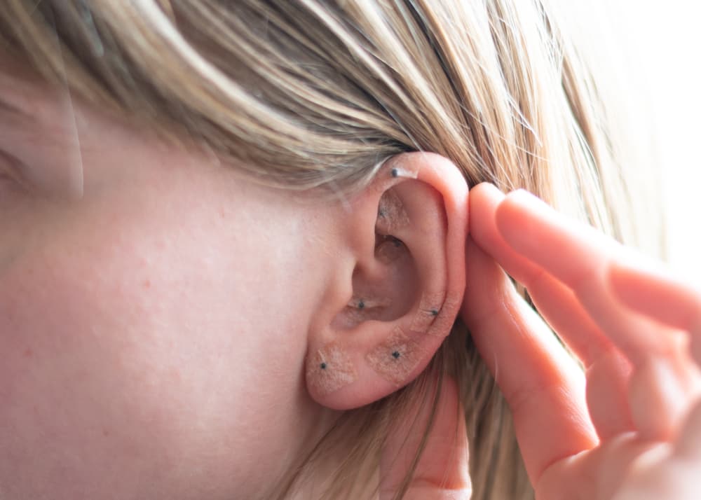 A practitioner showing acupuncture on the ear.