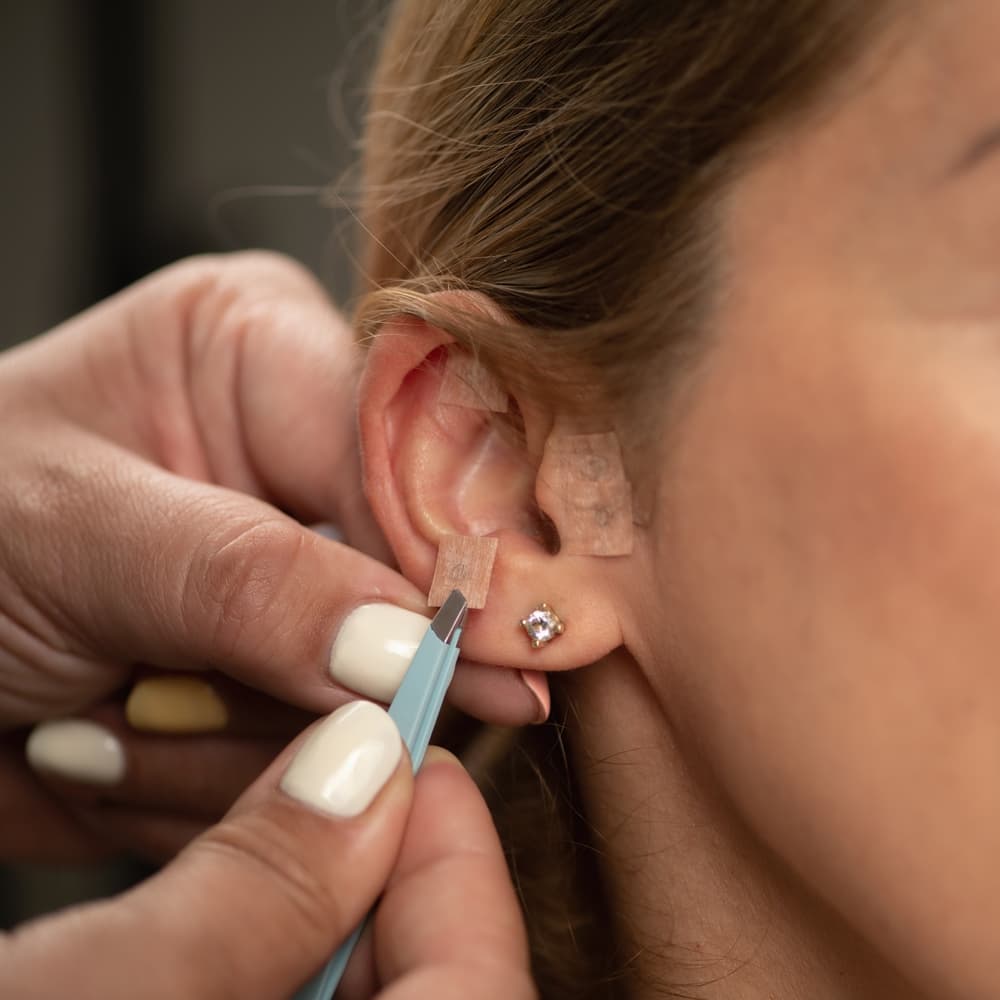 Ear seeds being placed on an ear with tweezers.