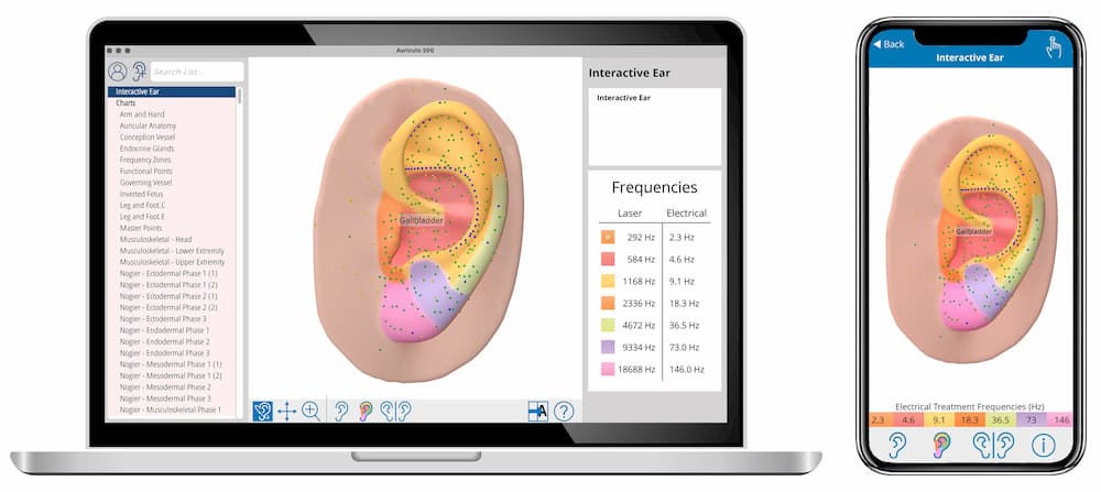 Auriculo 360 interactive ear with frequency zones visible.